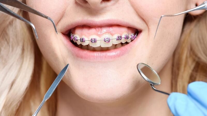 Orthodontist Doncaster